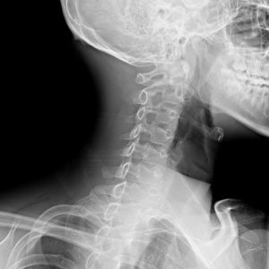 digital-x-ray-21